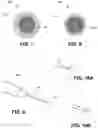 Fig. 07 - Personalization of excimer laser fibers