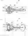 Fig. 05 - Earplug and pumping systems