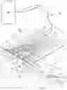 Fig. 02 - DRESSING WITH CONTRACTING LAYER FOR LINEAR TISSUE SITES
