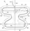 Fig. 01 - Area management of tissue sites on articulating joints