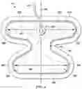Fig. 04 - Area management of tissue sites on articulating joints