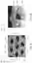 Fig. 04 - Apertured extrusion coated nonwoven web for absorbent articles and absorbent articles including same