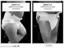 Fig. 09 - IMPROVEMENTS TO FASTENING SYSTEM OF DISPOSABLE ABSORBENT ARTICLES