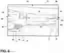 Fig. 06 - Head of bed access