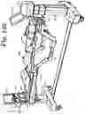 Fig. 136 - Patient positioning support apparatus with virtual pivot-shift pelvic pads, upper body stabilization and fail-safe table attachment mechanism