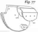 Fig. 77 - Patient positioning support apparatus with virtual pivot-shift pelvic pads, upper body stabilization and fail-safe table attachment mechanism