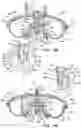 Fig. 08 - Vial adaptor assembly for a closed fluid transfer system