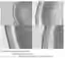 Fig. 01 - Compositions and methods for treating ocular pathologies