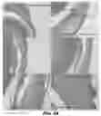 Fig. 06 - Compositions and methods for treating ocular pathologies