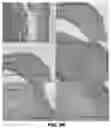 Fig. 07 - Compositions and methods for treating ocular pathologies