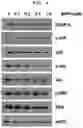 Fig. 06 - Pharmaceutical composition for treating or preventing Parkinson's disease comprising STT as an active ingredient