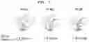 Fig. 09 - Pharmaceutical composition for treating or preventing Parkinson's disease comprising STT as an active ingredient