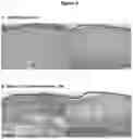 Fig. 04 - COMPOSITIONS AND METHODS OF TREATING SKIN FIBROTIC DISORDERS