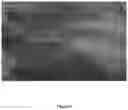 Fig. 05 - Pharmaceutical compositions for subcutaneous administration of levosimendan