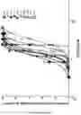 Fig. 09 - METHOD AND PHARMACEUTICAL COMPOSITIONS FOR THE TREATMENT OF MULTIPLE MYELOMA