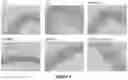 Fig. 07 - METHOD AND COMPOSITION FOR REVERSING AND/OR INHIBITING ATHEROSCLEROSIS