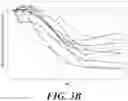 Fig. 05 - COMBINATION THERAPY FOR TREATING HEPATITIS B VIRUS INFECTION