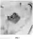 Fig. 02 - Method of treating or preventing hernia formation