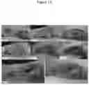 Fig. 02 - C. novyi for the treatment of solid tumors in humans
