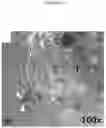 Fig. 09 - C. novyi for the treatment of solid tumors in humans