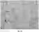 Fig. 22 - COMPOSITIONS AND METHODS FOR MODULATING ENDOTHELIAL CELL MIGRATION AND ANGIOGENESIS