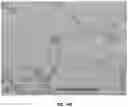 Fig. 27 - COMPOSITIONS AND METHODS FOR MODULATING ENDOTHELIAL CELL MIGRATION AND ANGIOGENESIS