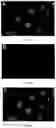 Fig. 03 - Bacteriologically-modified whole-cell tumor vaccine and method of making same