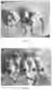 Fig. 04 - Bacteriologically-modified whole-cell tumor vaccine and method of making same