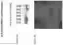 Fig. 15 - Modified norovirus VP1 proteins and VLPS comprising modified norovirus VP1 proteins