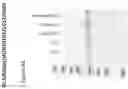 Fig. 17 - Modified norovirus VP1 proteins and VLPS comprising modified norovirus VP1 proteins