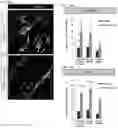 Fig. 12 - TREATMENT
