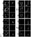 Fig. 14 - TREATMENT