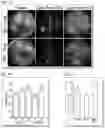 Fig. 19 - TREATMENT