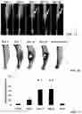 Fig. 02 - Anti-glucosaminidase passive immunization for infections