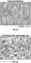 Fig. 08 - Gene therapy for eosinophilic disorders