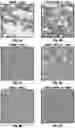 Fig. 09 - Gene therapy for eosinophilic disorders