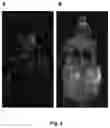 Fig. 05 - Preparation for magnetic resonance diagnostics for oncological diseases, comprising deuterated 3-O-methylglucose, and diagnostic method using said preparation