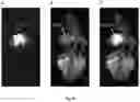 Fig. 07 - Preparation for magnetic resonance diagnostics for oncological diseases, comprising deuterated 3-O-methylglucose, and diagnostic method using said preparation