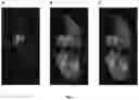Fig. 08 - Preparation for magnetic resonance diagnostics for oncological diseases, comprising deuterated 3-O-methylglucose, and diagnostic method using said preparation