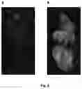 Fig. 09 - Preparation for magnetic resonance diagnostics for oncological diseases, comprising deuterated 3-O-methylglucose, and diagnostic method using said preparation