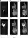 Fig. 11 - Preparation for magnetic resonance diagnostics for oncological diseases, comprising deuterated 3-O-methylglucose, and diagnostic method using said preparation