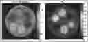 Fig. 01 - IMAGING PHANTOM