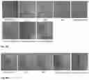 Fig. 05 - Synthesis and composition of photodynamic therapeutic agents for the targeted treatment of cancer