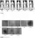 Fig. 37 - Synthesis and composition of photodynamic therapeutic agents for the targeted treatment of cancer