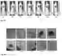 Fig. 47 - Synthesis and composition of photodynamic therapeutic agents for the targeted treatment of cancer