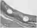 Fig. 01 - IMPLANTABLE DRUG-LOADED DEVICE