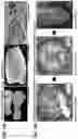 Fig. 07 - METHODS OF FORMING THREE-DIMENSIONAL TISSUES SCAFFOLDS USING BIOLOGICAL FIBER INKS AND METHODS OF USE THEREOF