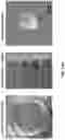 Fig. 16 - METHODS OF FORMING THREE-DIMENSIONAL TISSUES SCAFFOLDS USING BIOLOGICAL FIBER INKS AND METHODS OF USE THEREOF