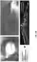 Fig. 17 - METHODS OF FORMING THREE-DIMENSIONAL TISSUES SCAFFOLDS USING BIOLOGICAL FIBER INKS AND METHODS OF USE THEREOF