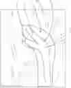 Fig. 01 - Shield for recurrent laryngeal nerve and associated methods